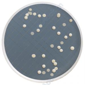 Sabouraud Dextrose Agar カセット 48/箱 [MXSMCSD48]